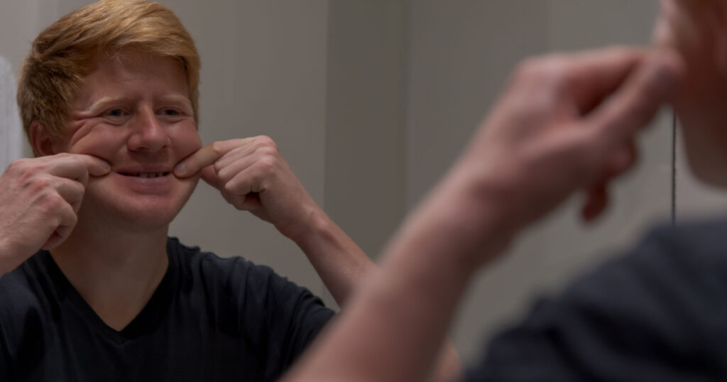 Sad caucasian redhead man in black t-shirt forces himself to smile by pulling his cheeks to the sides with his hands in front of mirror. Selective focus. Mental health theme.
