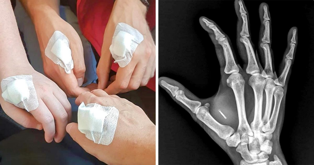 People in Sweden Are Upgrading Their Hands, and It Makes Us a Little Scared - Featured image