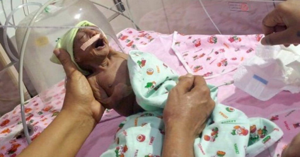 This Baby Was Rejected By Parents Because Of Her Strange Skin, But Her Grandfather Saved Her - Featured image