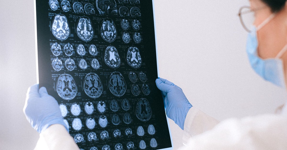 A medical professional reviewing MRI brain scans in a clinical setting, highlighting healthcare technology.
