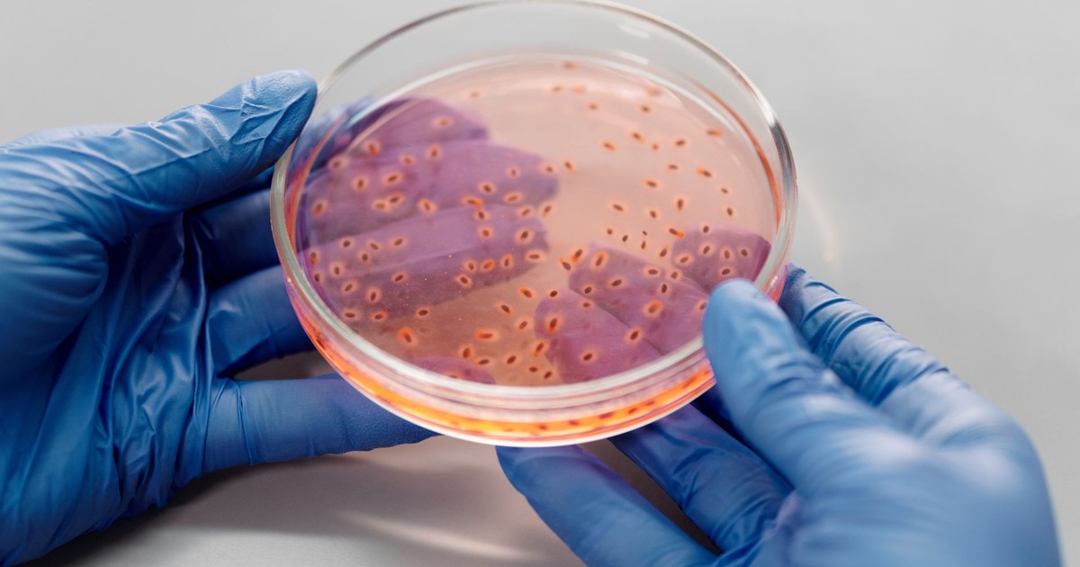 Close-up of gloved hands holding a petri dish with bacterial culture in a lab setting.