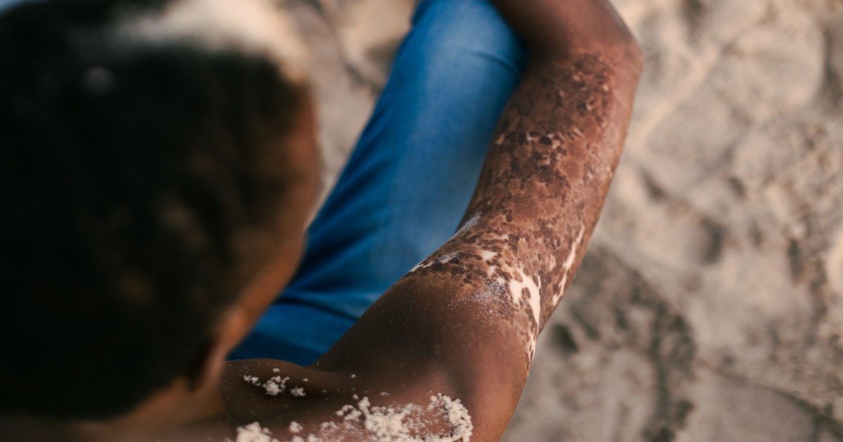 Close-up view of a person relaxing on a sandy beach in Lagos, Nigeria, showcasing natural beauty and unique skin tones.